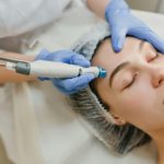Botox Alternatives for Migraine Prevention Botox Alternatives Migraine Prevention