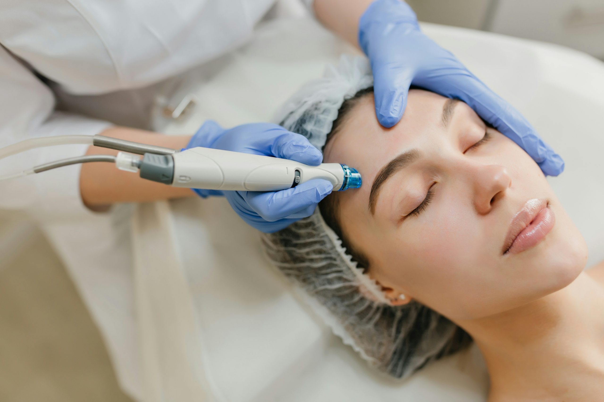 Botox Alternatives Migraine Prevention